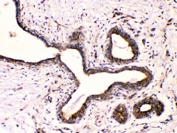 Tubulin beta 3 Antibody / TUBB3