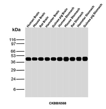 Western blot analysis of Human Brain, Mouse Brain, Rat Brain, Hamster Brain, Guinea pig Brain, Human