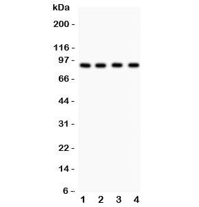 Western blot testing of Furin antibody and Lane 1: HeLa; 2: MCF-7; 3: COLO320; 4: SW620. Observed mo