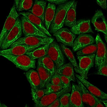 Pan Cytokeratin Antibody Cocktail (Acidic + Basic)