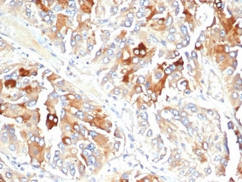 IHC staining of FFPE human adrenal gland tissue with APO-J antibody (clone CLU/4723). HIER: boil tissue sections in pH 9 10mM Tris with 1mM EDTA for 20 min and allow to cool before testing.