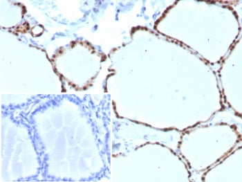 IHC staining of FFPE human thyroid tissue with PAX8 antibody (clone PAX8/8973R). HIER: boil tissue s