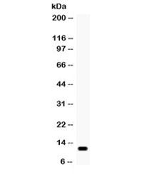 Western blot testing of human SW620 cell lysate with MCP1 antibody. Expected/observed molecular weig