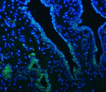Immunofluorescent staining of FFPE human prostate cancer tissue with SLC22A8 antibody (green) and DA