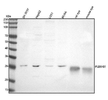 Western blot analysis of PLEKHB1 using anti-PLEKHB1 antibody. Lane 1: human SH-SY5Y whole cell lysat