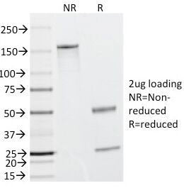SDS-PAGE Analysis of Purified, BSA-Free CAD Antibody (clone h-CALD). Confirmation of Integrity and P
