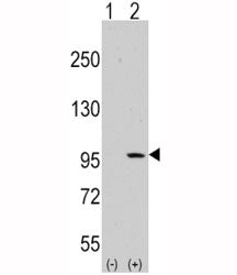 Western blot analysis of DDR1 antibody and 293 cell lysate (2 ug/lane) either nontransfected (Lane 1