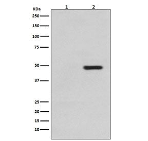 Western blot testing of 1) lysate from untreated SH-SY5Y cells and 2) lysate from sorbitol-treated S