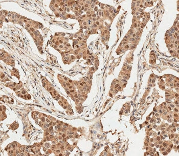 Ubiquitin Antibody, 0.4ml