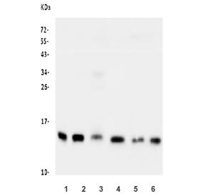 Western blot testing of human 1) PC-3, 2) Caco-2, 3) placenta, 4) A549, 5) COLO-320 and 6) HEK293 ly