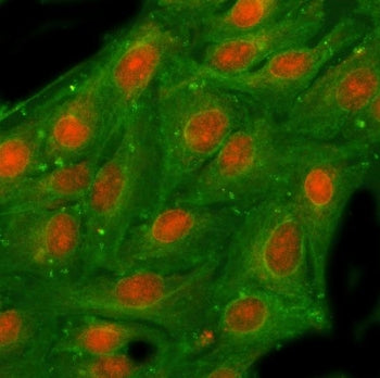 Immunofluorescent staining of FFPE human A549 cells with NSFL1C antibody (red) and Beta Tubulin mAb 
