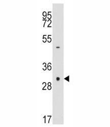 Caspase-3 Antibody