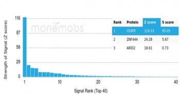 Analysis of a HuProt(TM) microarray containing more than 19,000 full-length human proteins using C/E