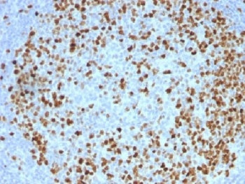 IHC testing of FFPE human tonsil with TOP2A antibody (clone TOP2A/1362). Required HIER: boil section