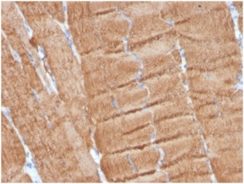 IHC staining of FFPE human skeletal muscle with Actin alpha 1 antibody (clone ACTA1/360). HIER: boil tissue sections in pH 9 10mM Tris with 1mM EDTA for 20 min and allow to cool before testing.