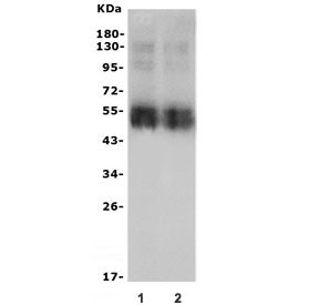 Western blot testing of rat liver lysate (lane 1-2) with NTCP1 antibody. Expected molecular weight: 