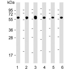 Western blot testing of human 1) Jurkat, 2) HeLa, 3) HepG2, 4) MCF7, 5) mouse NIH 3T3 and 6) rat PC-