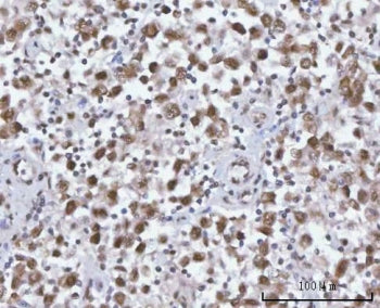 IHC staining of FFPE human testicular seminoma tissue with SF3a66 antibody. HIER: boil tissue sectio