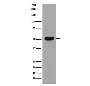 Western blot testing of human spleen lysate with Human IgG4 antibody. Predicted molecular weight ~50
