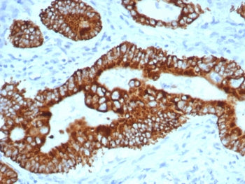 AMACR / p504S Antibody (Prostate Cancer Marker)