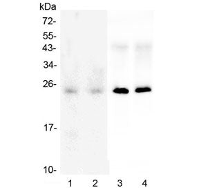 Western blot testing of 1) human HeLa, 2) human U-87 MG, 3) rat brain and 4) mouse brain lysate with