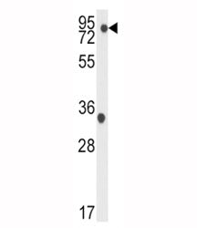 TBK1 Antibody