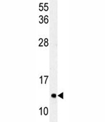 LC3C Antibody / MAP1LC3C, 0.08ml