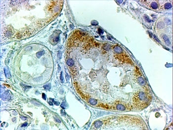 IHC testing of FFPE human kidney with AADAT antibody at 2ug/ml. HIER: steamed with pH6 citrate buffe