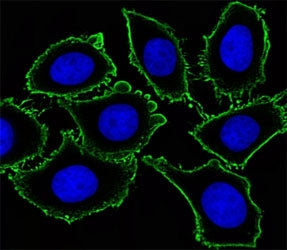 Immunofluorescent analysis of U251 cells using KIT antibody. Ab was diluted at 1:100 dilution. Dylig