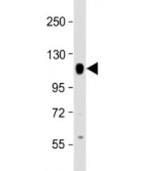 Western blot testing of human A549 cell lysate with PTPN12 antibody at 1:2000. Predicted molecular w