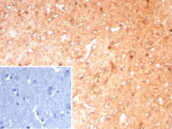 IHC staining of FFPE human brain tissue with GLUL antibody (clone GLUL/8889R). Inset: PBS used in pl