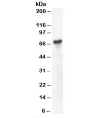 Western blot testing of Daudi lysate with BLNK antibody at 4ug/ml. Predicted molecular weight: ~51kD