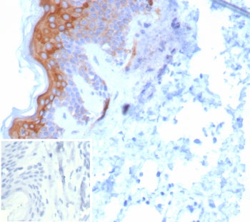Keratin 6 Antibody / Cytokeratin 6