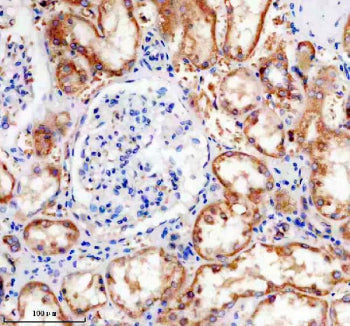 IHC staining of FFPE human kidney tissue with Phospho-Tau antibody, HRP-secondary and DAB substrate.