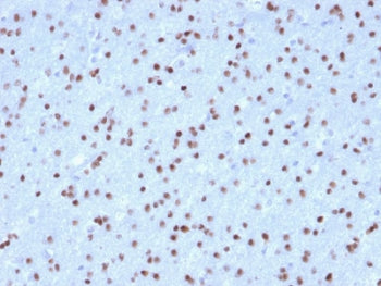 IHC testing of FFPE human cerebellum with OLIG2 antibody (clone OLIG2/2400). HIER: boil tissue secti