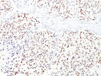 MITF Antibody Cocktail