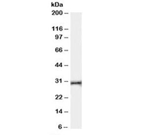 HVEM Antibody