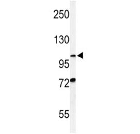 Western blot analysis of HIF1 alpha antibody and CHO lysate. Routinely observed molecular weight: 10