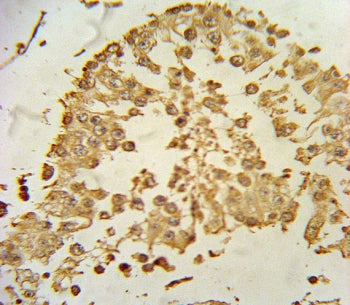 IHC testing of FFPE human testis tissue with ZDHHC21 antibody. HIER: steam section in pH6 citrate bu