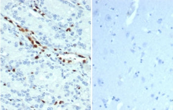ERG Antibody / Transcriptional regulator ERG