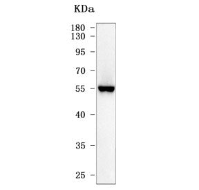 Western blot testing of human K562 cell lysate with ALDH1A2 antibody. Predicted molecular weight ~56