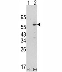 Western blot analysis of PDK1 antibody and 293 cell lysate (2 ug/lane) either nontransfected (Lane 1