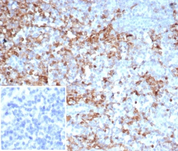 IHC staining of FFPE human tonsil tissue with SERPINA1 antibody (clone AAT/6325). Inset: PBS used in