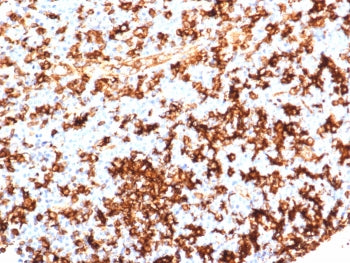 IHC staining of FFPE human tonsil tissue with HLA-DR antibody (clone HLA-DRA/6839R). HIER: boil tiss