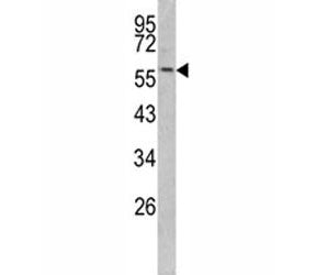Western blot analysis of Keratin-14 antibody and mouse NIH3T3 lysate.