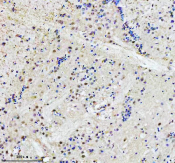 IHC staining of FFPE zebrafish brain tissue with Adrm1 antibody. HIER: boil tissue sections in pH8 E