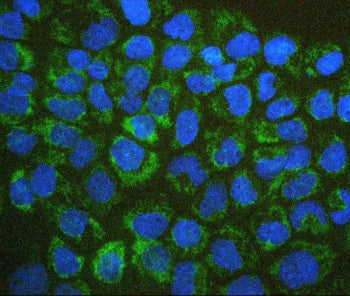 Immunofluorescent staining of FFPE human A431 cells with BAK1 antibody (green) and DAPI (blue). HIER