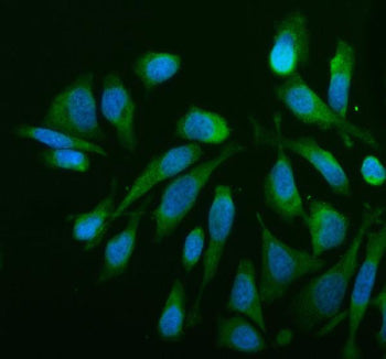 Immunofluorescent staining of MTCH2 using anti-MTCH2 antibody (green). MTCH2 was detected in an immu