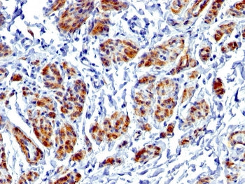 IHC testing of FFPE human uterus with recombinant Caldesmon antibody (clone CALD1/1424R). Required H