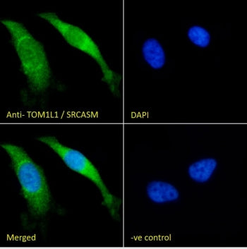 IF/ICC staining of fixed and permeabilized human HeLa cells with TOM1L1 antibody (green) at 10ug/ml 